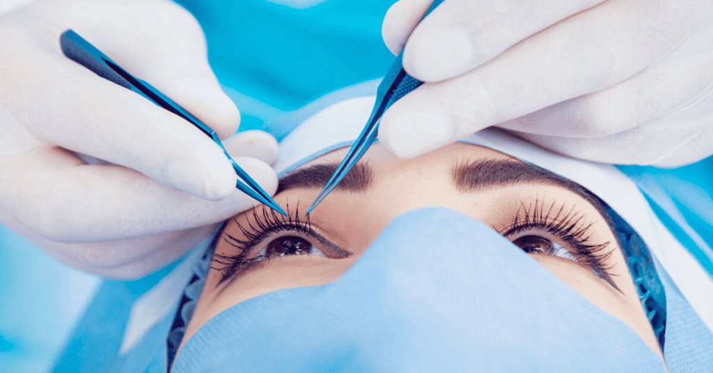 What is Eyelid Surgery Called Blepharoplasty