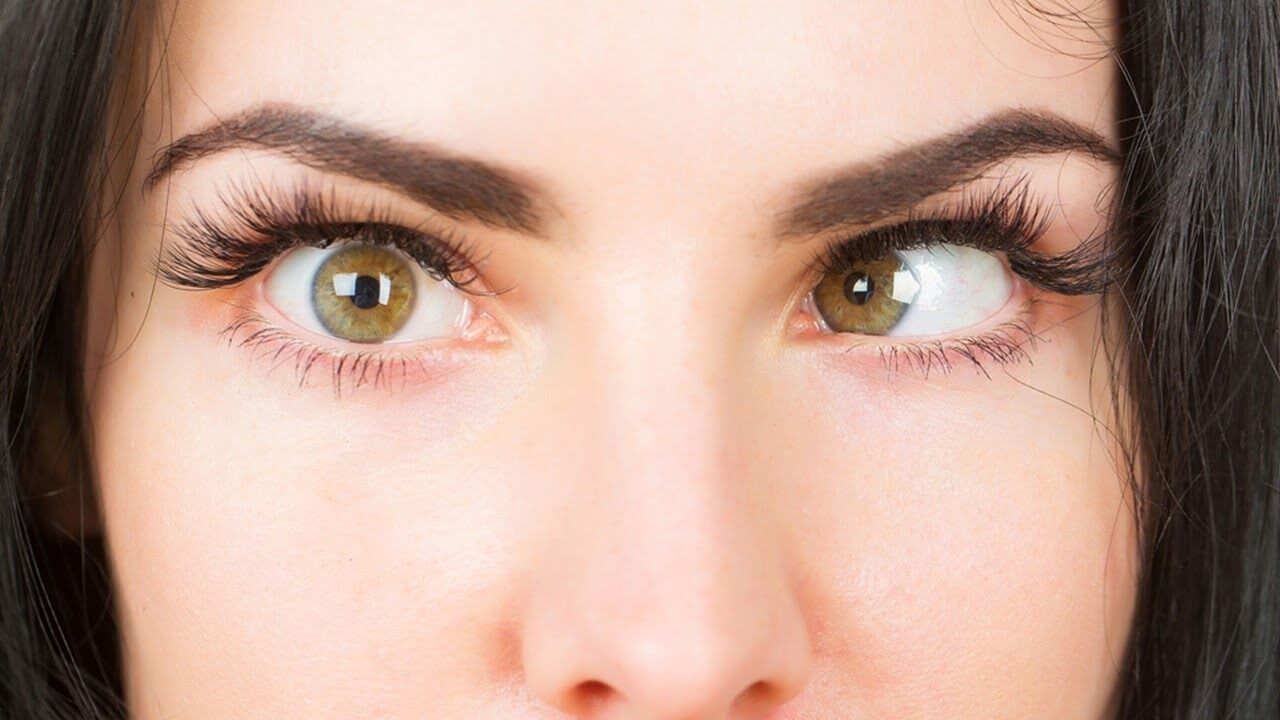 Squint Eye Exercises to Improve Eye Alignment Naturally
